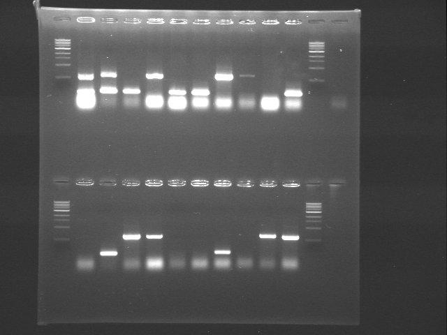 HepB colony PCR 19-7.jpg