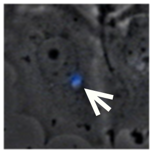 Figure X.  Close up image of what appears to be eCFP fluorescence from a transfected MCF7 cell. 
