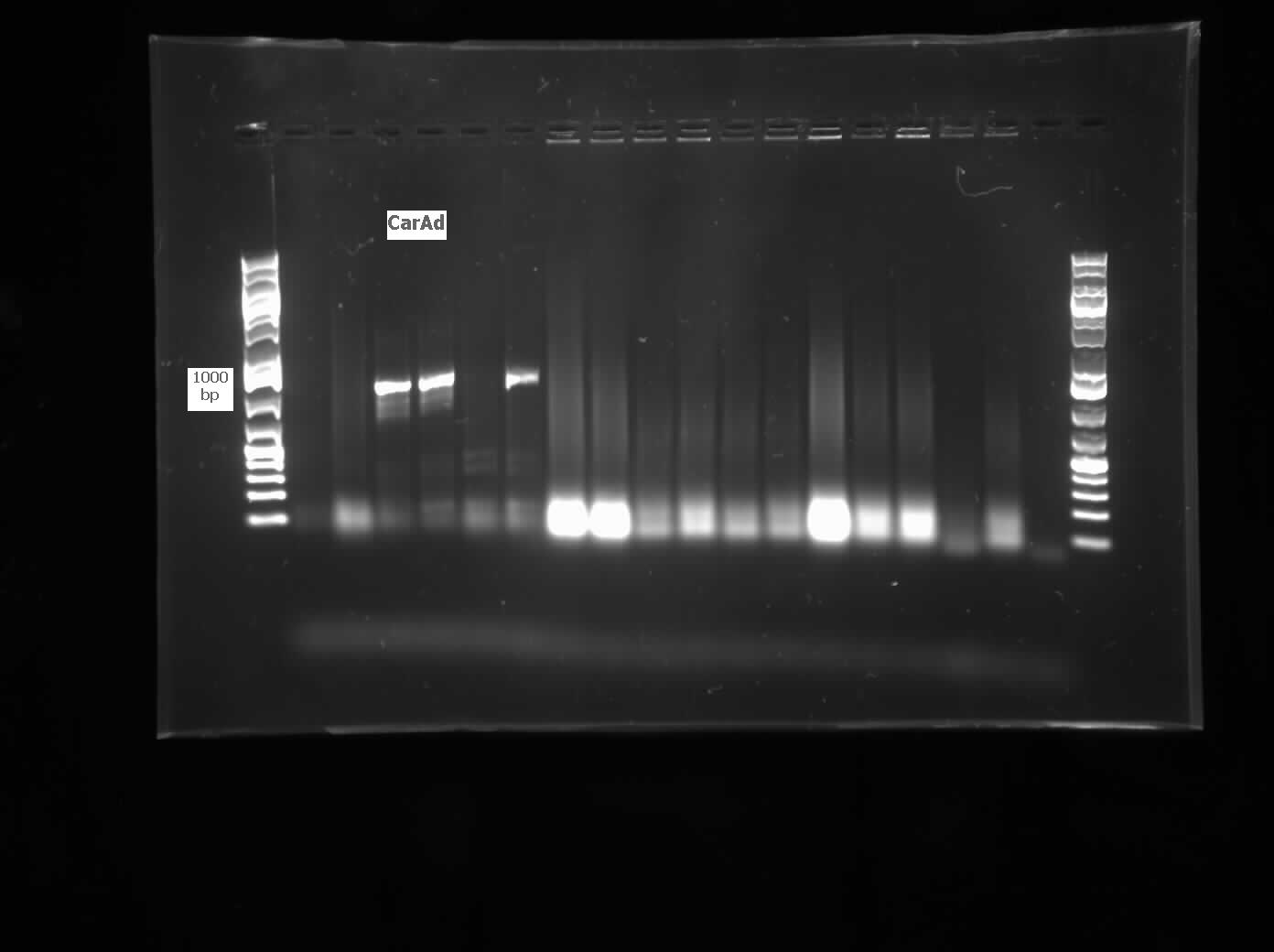 07.20.2012 CarAd colony PCR from LD2.jpg