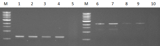 RT-PCR.jpg