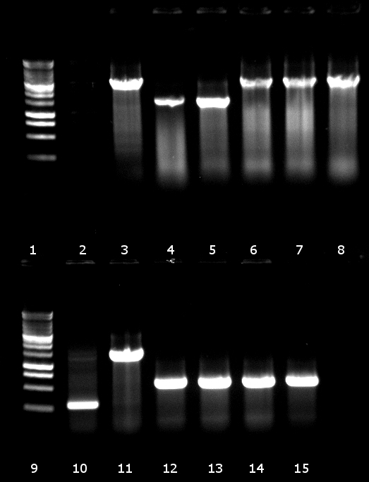 120815 Kolonie PCR.jpg