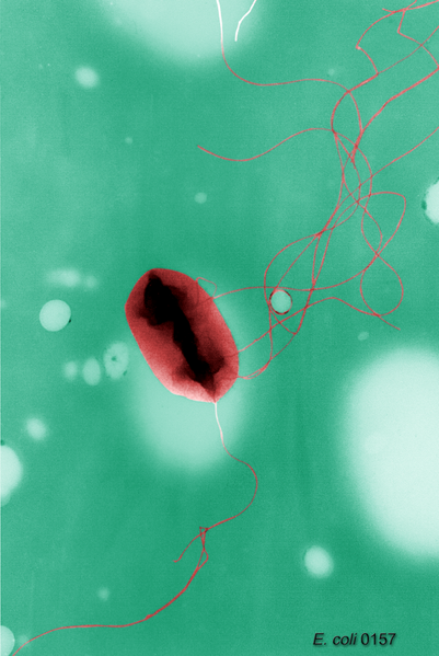 Bielefeld2012 E.coli.jpg