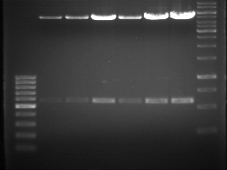 TUM12 20120903 anal gel p534-p539.jpg